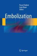 Embolization