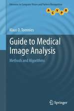 Guide to Medical Image Analysis: Methods and Algorithms