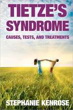 Tietze's Syndrome: Causes, Tests, and Treatments