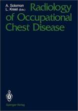 Radiology of Occupational Chest Disease