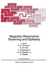 Magnetic Resonance Scanning and Epilepsy