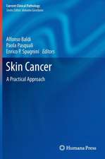 Skin Cancer: A Practical Approach