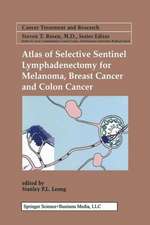 Atlas of Selective Sentinel Lymphadenectomy for Melanoma, Breast Cancer and Colon Cancer