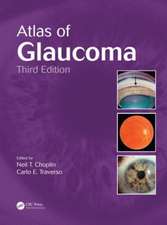 Atlas of Glaucoma