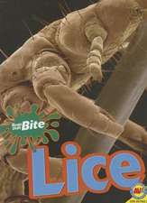 Lice