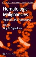 Hematologic Malignancies