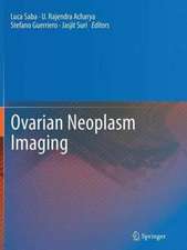 Ovarian Neoplasm Imaging