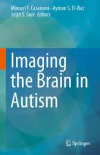 Imaging the Brain in Autism