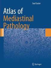 Atlas of Mediastinal Pathology