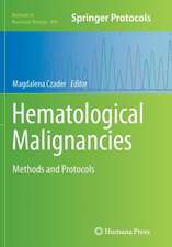 Hematological Malignancies