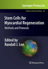 Stem Cells for Myocardial Regeneration: Methods and Protocols