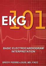 EKG 101