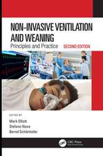 Non-Invasive Ventilation and Weaning: Principles and Practice, Second Edition