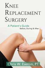 Knee Replacement Surgery, a Patient's Guide