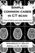 Simple Common Cases in CT Scan