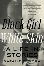 Black Girl White Skin: A Life in Stories Volume 1