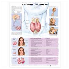 Thyroid Disorders Anatomical Chart