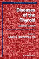 Diseases of the Thyroid