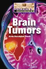 Brain Tumors