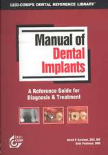 Manual of Dental Implants