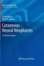 Cutaneous Neural Neoplasms: A Practical Guide