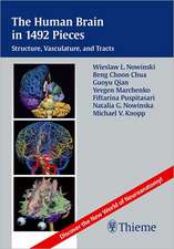 The Human Brain in 1492 Pieces: Structure, Vasculature, and Tracts