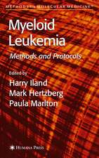 Myeloid Leukemia: Methods and Protocols