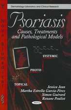 Psoriasis: Causes, Treatments & Pathological Models