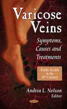 Varicose Veins