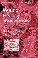 Wound Healing: Methods and Protocols