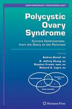 Polycystic Ovary Syndrome: Current Controversies, from the Ovary to the Pancreas