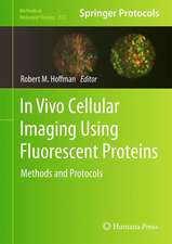 In Vivo Cellular Imaging Using Fluorescent Proteins: Methods and Protocols