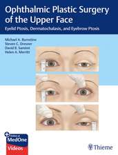 Ophthalmic Plastic Surgery of the Upper Face – Eyelid Ptosis, Dermatochalasis, and Eyebrow Ptosis