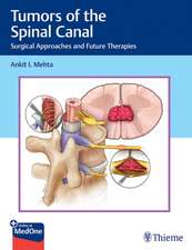 Tumors of the Spinal Canal – Surgical Approaches and Future Therapies