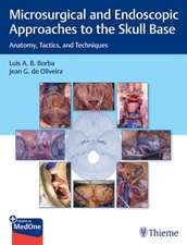 Microsurgical and Endoscopic Approaches to the S – Anatomy, Tactics, and Techniques