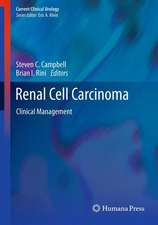 Renal Cell Carcinoma: Clinical Management