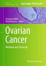 Ovarian Cancer: Methods and Protocols