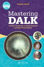 Mastering DALK