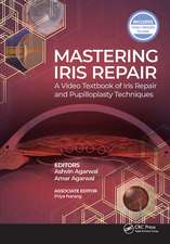 Mastering Iris Repair: A Video Textbook of Iris Repair and Pupilloplasty Techniques