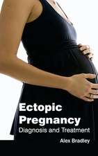 Ectopic Pregnancy