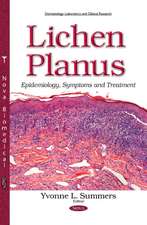 Lichen Planus: Epidemiology, Symptoms & Treatment