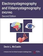 Electronystagmography/Videonystagmography (ENG/VNG)