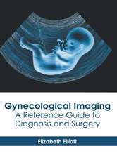 Gynecological Imaging: A Reference Guide to Diagnosis and Surgery