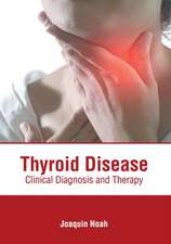 Thyroid Disease: Clinical Diagnosis and Therapy