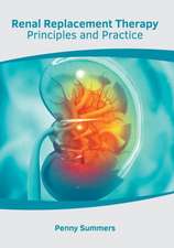 Renal Replacement Therapy: Principles and Practice