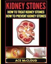 Kidney Stones