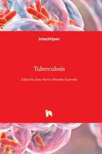 Tuberculosis