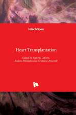 Heart Transplantation