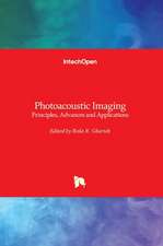 Photoacoustic Imaging