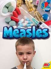 Measles